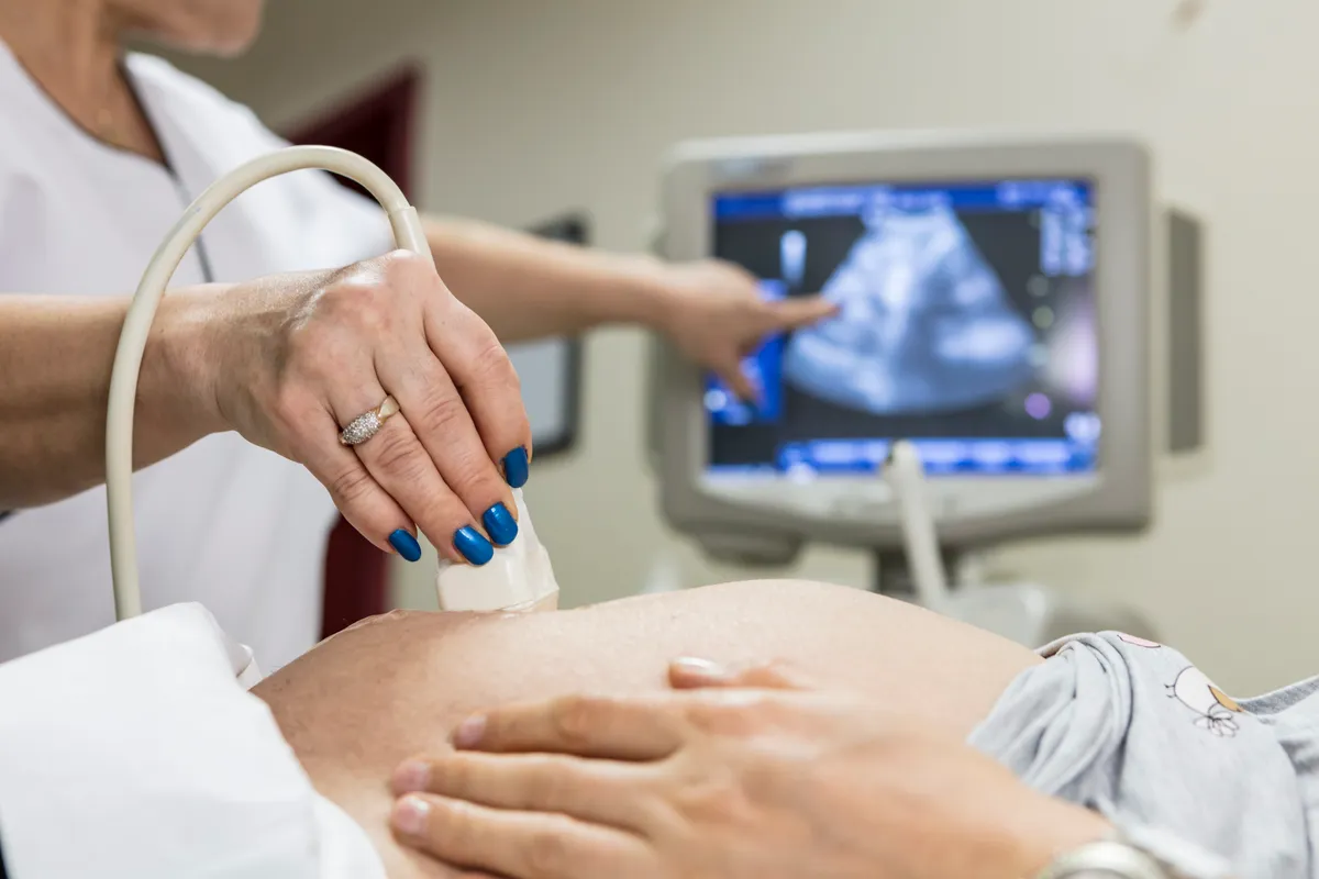 Ultrasonido durante el embarazo