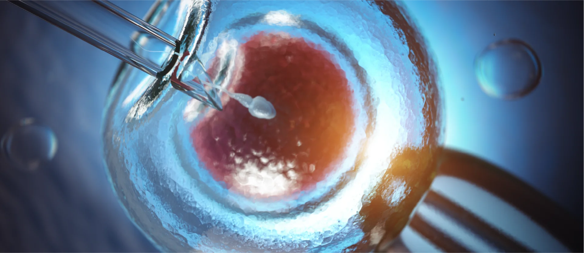 IVF Accesible Initia